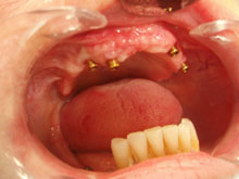 Oralna kirurgija i parodontologija