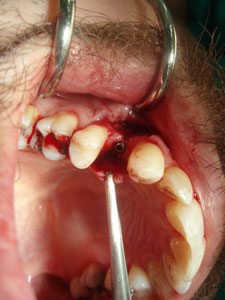 Oralna kirurgija i parodontologija